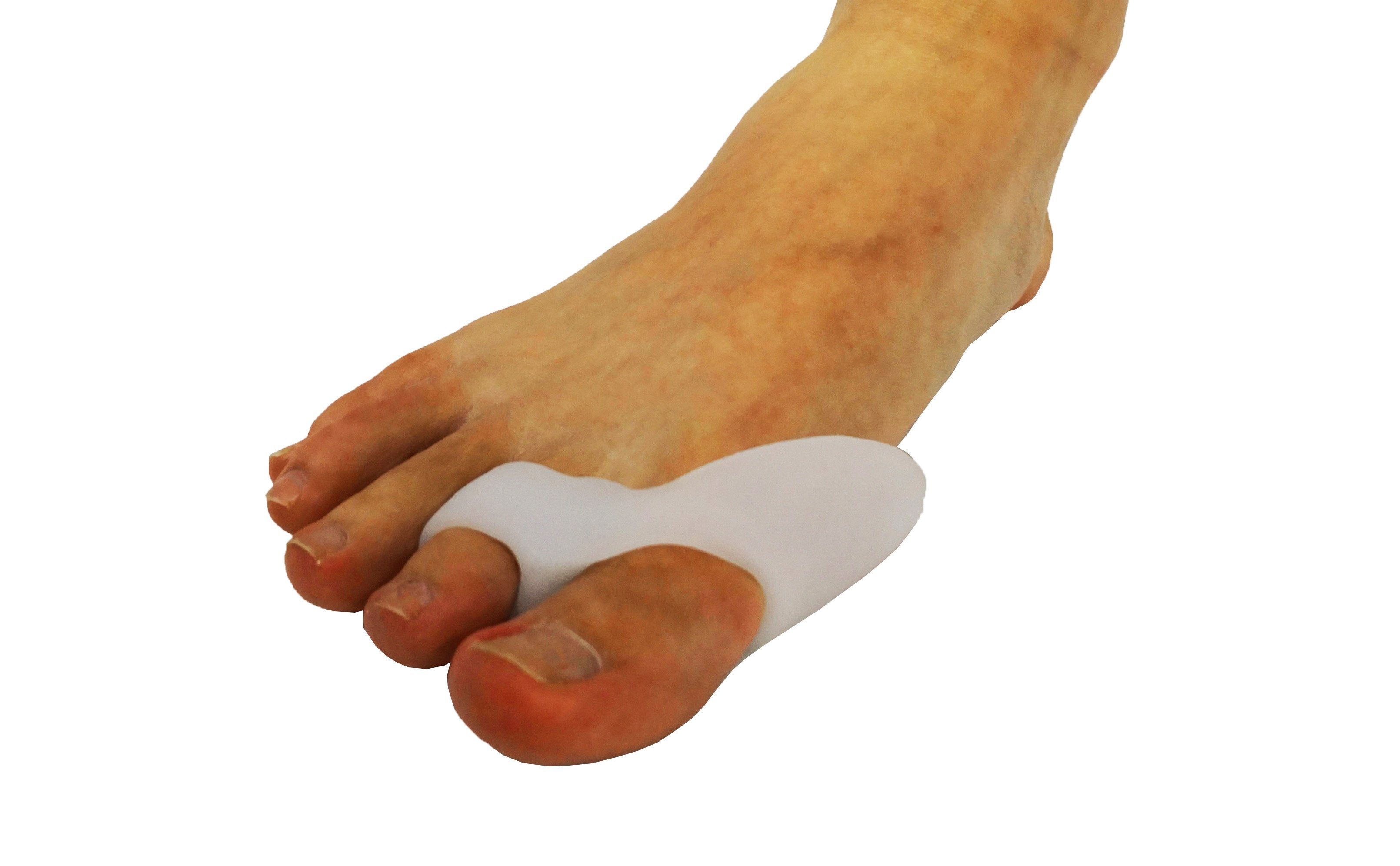 Sleeva Bunion Corrector